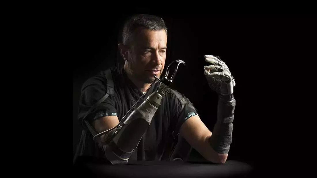 Bridging the Gap: AI Enhances Bionic Hand Functionality for Amputees