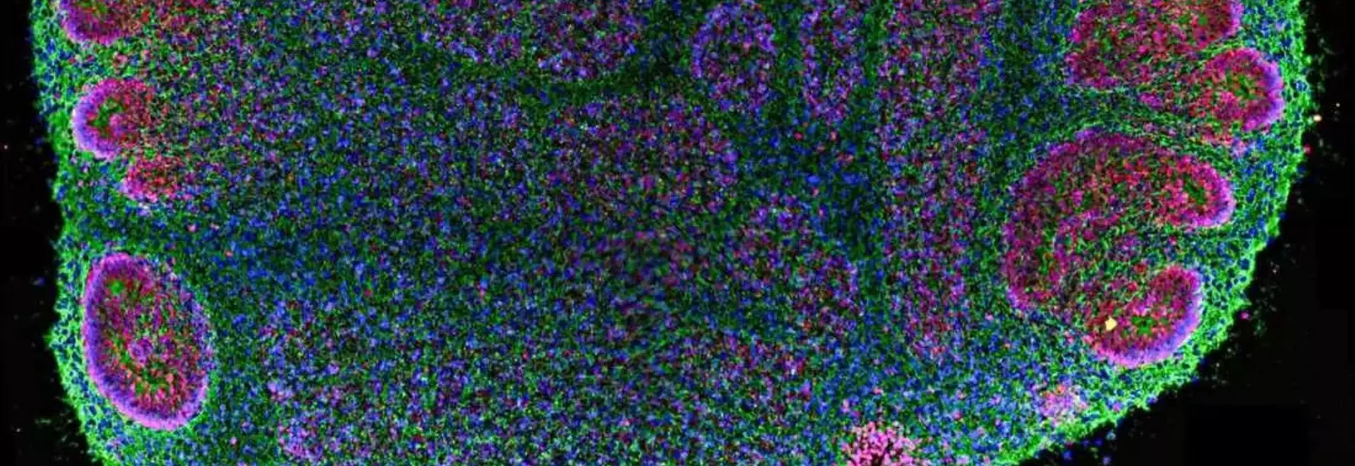 Brain Organoids: Advancements and Ethical Complexities in Neural Research