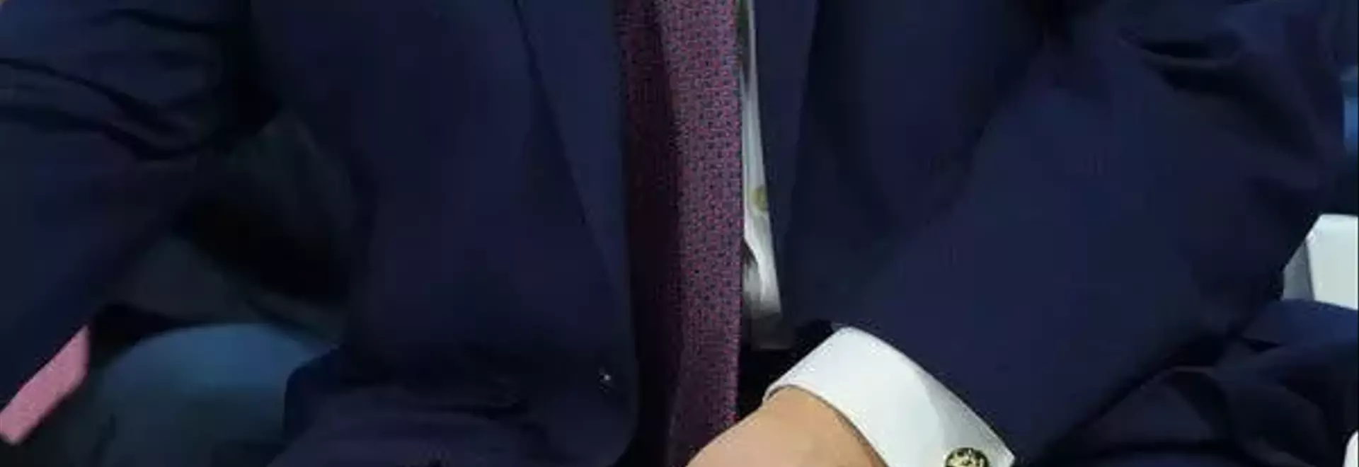 Trump Explains Hand Bruise Amid Health Speculation