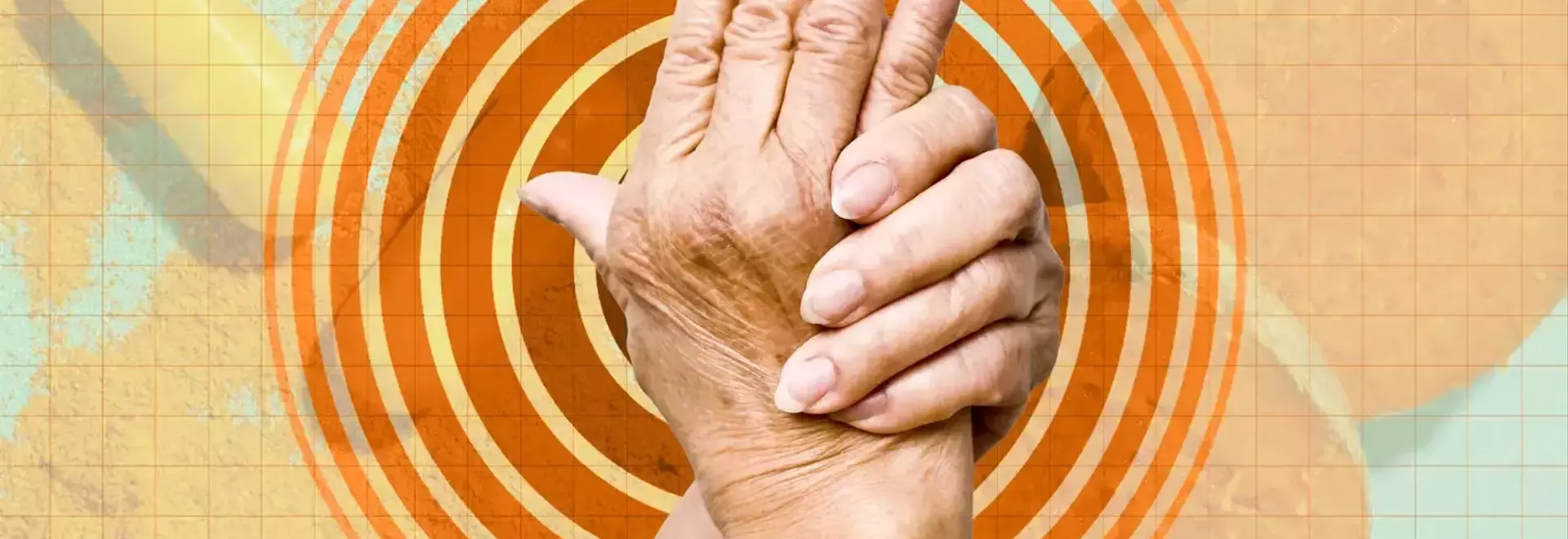 Dietary Strategies to Mitigate Arthritis Flare-Ups