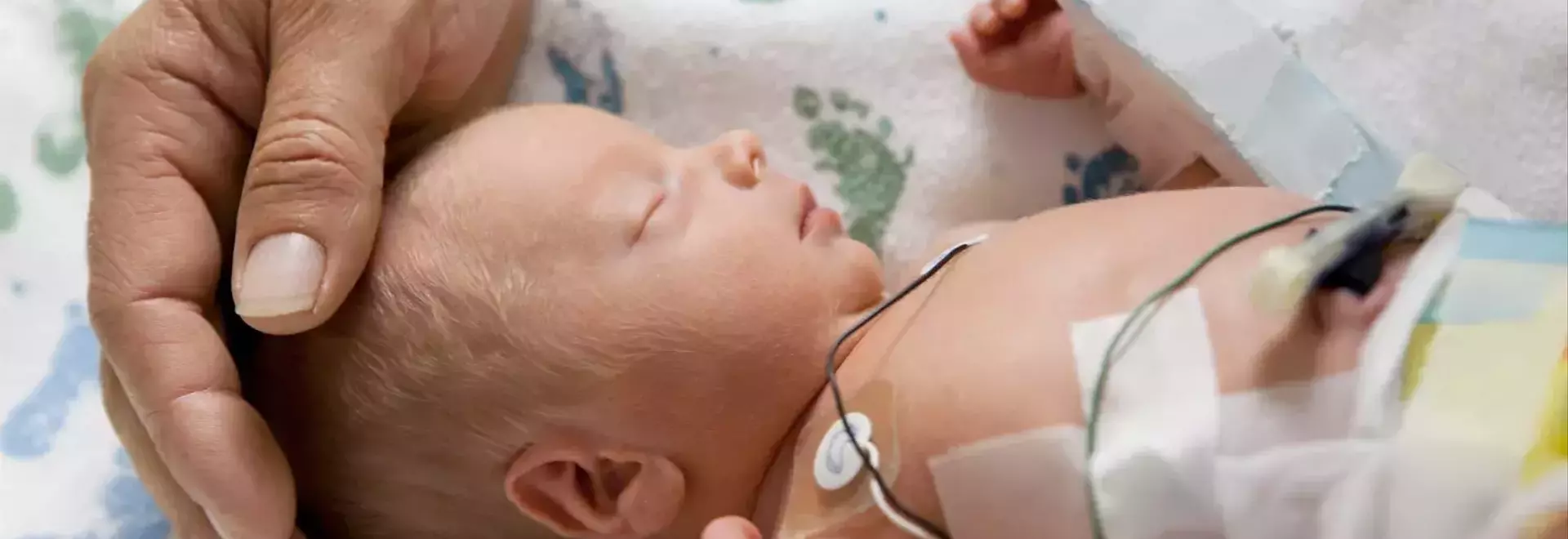 Understanding SSI Benefits for Premature Babies: A Comprehensive Guide