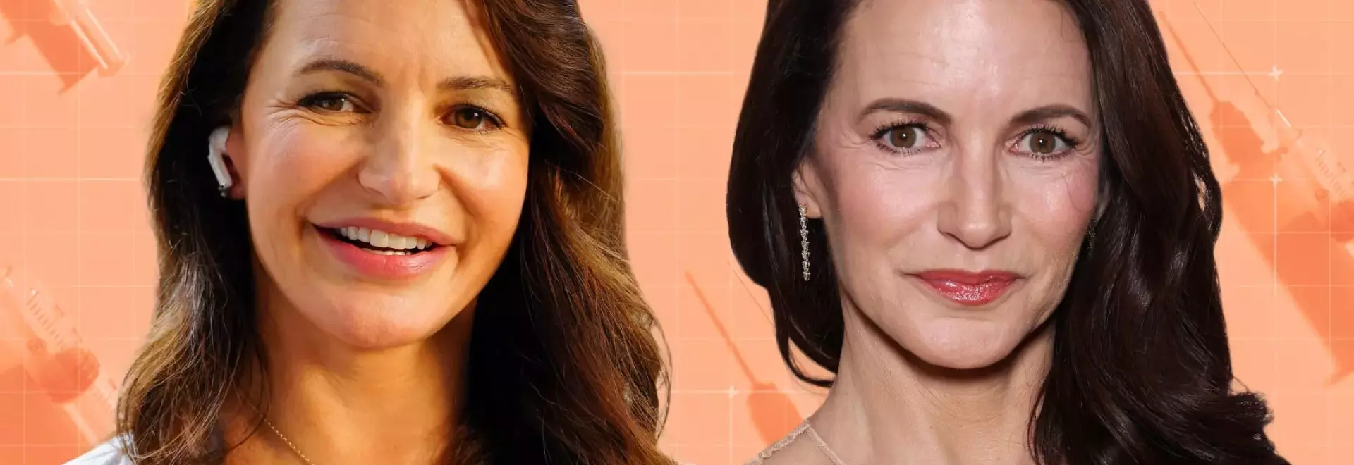 The Facial Filler Backlash: A Deep Dive into Celebrity Experiences and Expert Opinions