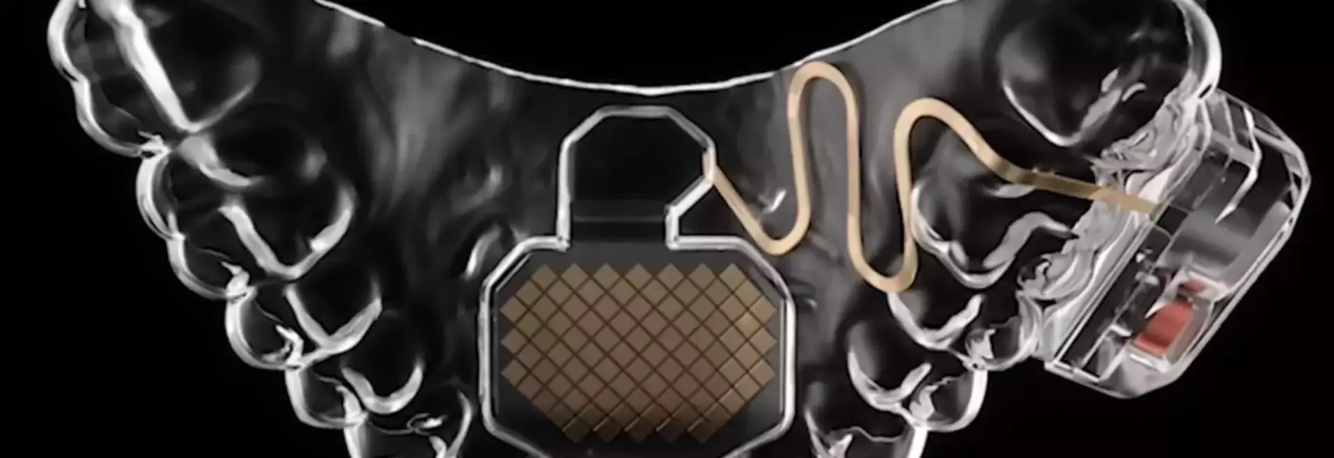 Tongue-Controlled Mouth Pad Enables Hands-Free PC Interaction