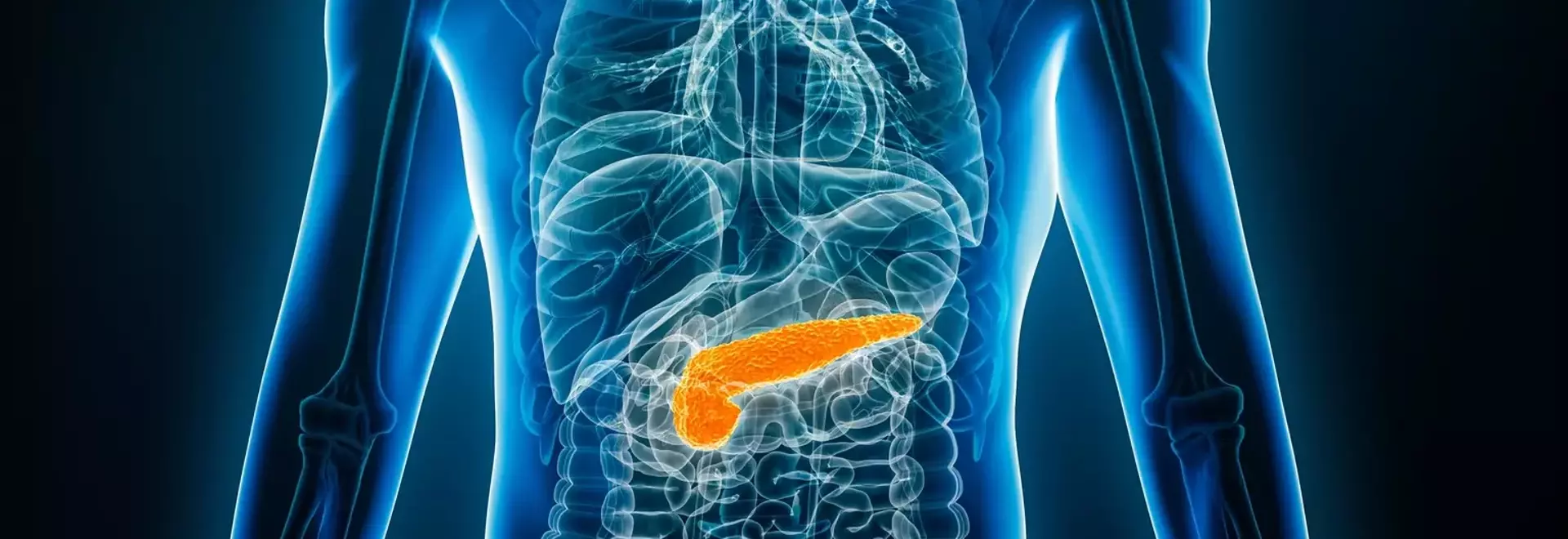 Tango Therapeutics' Vopimetostat Shows Early Promise in Pancreatic Cancer Treatment