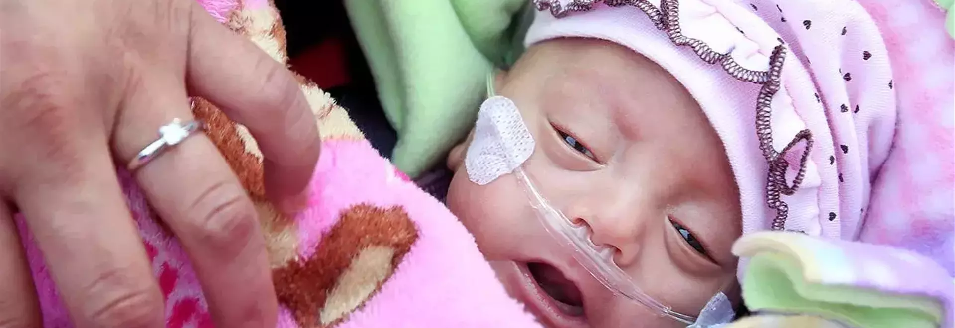 The Amazing Resilience of Premature Babies: Stories of Survival and Hope